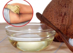 Chữa bệnh trĩ bằng dầu dừa như thế nào? Hiệu quả không?